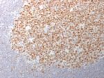 Bcl-6 (Follicular Lymphoma Marker) (BCL6/1982), CF568 conjugate, 0.1mg/mL