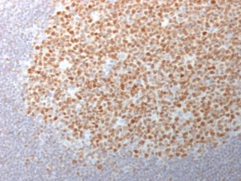 Bcl-6 (Follicular Lymphoma Marker) (BCL6/1982), CF568 conjugate, 0.1mg/mL
