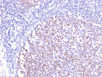 Bcl-6 (Follicular Lymphoma Marker)(BCL6/2497R), 0.2mg/mL