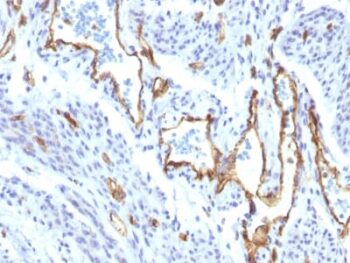 CD31 / PECAM-1 (Endothelial Cell Marker) (C31/1395R), 0.2mg/mL