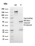CD1a / HTA1 (Mature Langerhans Cells Marker)(C1A/3249), CF640R conjugate, 0.1mg/mL