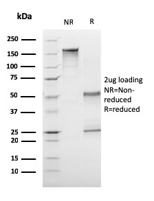 CD1a / HTA1 (Mature Langerhans Cells Marker)(C1A/3249), CF640R conjugate, 0.1mg/mL