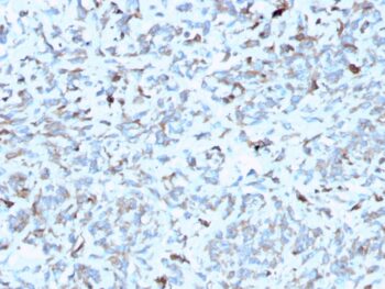 C1QA / Complement C1q A-Chain(C1QA/2952), 0.2mg/mL