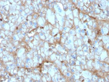 C1QA / Complement C1q A-Chain(C1QA/2954), 0.2mg/mL