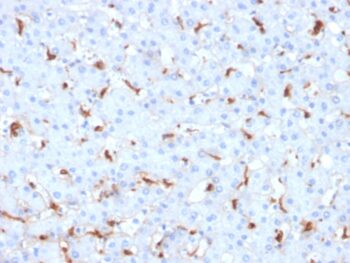 C1QB / Complement C1q B-Chain(C1QB/2961), 0.2mg/mL