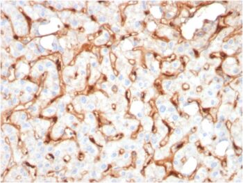 C1QB / Complement C1q B-Chain(C1QB/2965), 0.2mg/mL