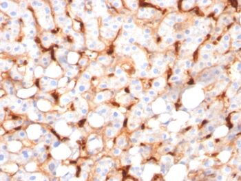 C1QB / Complement C1q B-Chain(C1QB/2966), 0.2mg/mL