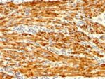 Calponin-1 (Smooth Muscle Marker) (CNN1/1408R), CF488A conjugate, 0.1mg/mL