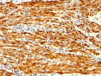Calponin-1 (Smooth Muscle Marker) (CNN1/1408R), CF488A conjugate, 0.1mg/mL
