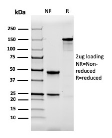 Calbindin 1 (CALB1)(CALB1/2364), CF740 conjugate, 0.1mg/mL
