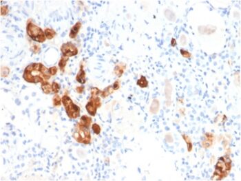 Calbindin 1 (CALB1)(CALB1/2782), CF405S conjugate, 0.1mg/mL