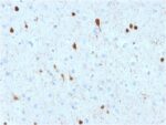 Calretinin / Calbindin 2 (Mesothelioma Marker)(CALB2/2602), 0.2mg/mL
