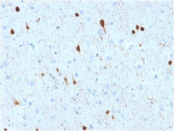 Calretinin / Calbindin 2 (Mesothelioma Marker)(CALB2/2602), 0.2mg/mL