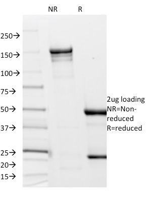 Borrelia burgdorferi (p41 Flagellin)(6802),  Biotin conjugate, 0.1mg/mL