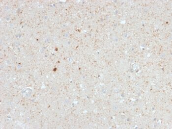 Calretinin / Calbindin 2 (Mesothelioma Marker)(CALB2/2603), 0.2mg/mL