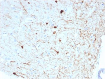 Calretinin / Calbindin 2 (Mesothelioma Marker)(CALB2/2786), 0.2mg/mL