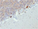 Calretinin / Calbindin 2 (Mesothelioma Marker)(CALB2/2807), 0.2mg/mL