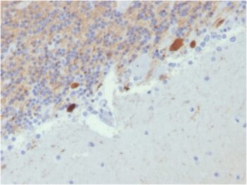 Calretinin / Calbindin 2 (Mesothelioma Marker)(CALB2/2807), 0.2mg/mL
