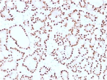 Cyclin D1 (G1-Cyclin & Mantle Cell Lymphoma Marker)(CCND1/2593), CF640R conjugate, 0.1mg/mL