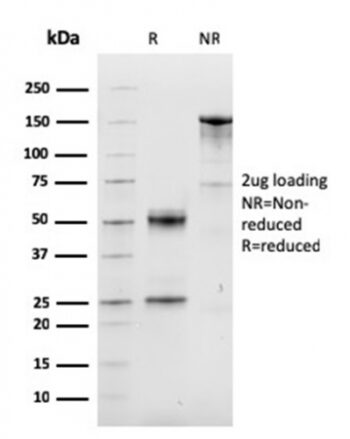 Cyclin D1 (G1-Cyclin & Mantle Cell Lymphoma Marker)(CCND1/3548), CF640R conjugate, 0.1mg/mL
