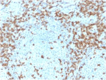 CD5 (Mantle Cell Lymphoma Marker)(CD5/2418), CF488A conjugate, 0.1mg/mL
