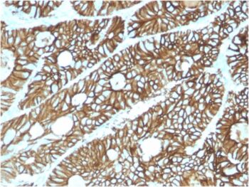 Cadherin 17 / LI Cadherin (Liver-Intestine Marker)(CDH17/2615), CF488A conjugate, 0.1mg/mL