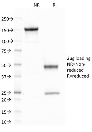 CELA3B / ELA3B (Pancreatic Function Marker)(CELA3B/1758), CF405S conjugate, 0.1mg/mL