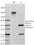 Creatine Kinase-BB (CK-BB) (CKBB/1268), Biotin conjugate, 0.1mg/mL