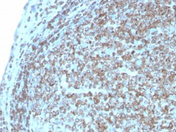 CD74 (B-Cell Marker)(CLIP/3127R), 0.2mg/mL