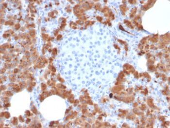 Carboxypeptidase A1 / CPA1 (Pancreatic Cancer Marker)(CPA1/2714), 0.2mg/mL