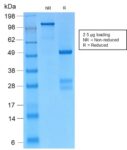 Catenin, gamma (Cardiomyocyte Marker)(CTNG/2155R), 1mg/mL