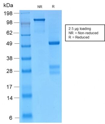 Catenin, gamma (Cardiomyocyte Marker)(CTNG/2155R), 1mg/mL