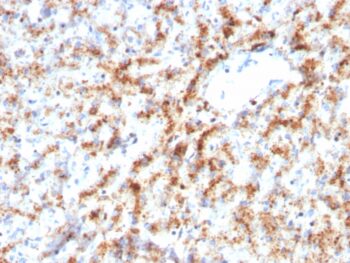 Cathepsin D (Tumor Marker)(CTSD/3082), 0.2mg/mL
