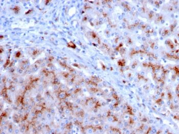 Cathepsin D (Tumor Marker)(CTSD/3083), 0.2mg/mL