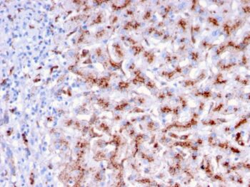 Cathepsin D (Tumor Marker)(CTSD/3276), 0.2mg/mL