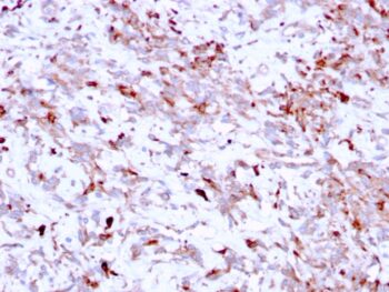 Cathepsin K (Marker of Tumor Invasiveness)(CTSK/2791), 0.2mg/mL