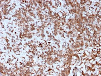 Cathepsin K (Marker of Tumor Invasiveness)(CTSK/2792), 0.2mg/mL