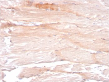 Dystrophin (DMD) (Marker of Duchenne and Becker Muscular Dystrophy)(DMD/3241), CF640R conjugate, 0.1mg/mL