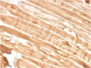 Dystrophin (DMD) (Marker of Duchenne and Becker Muscular Dystrophy)(DMD/3244), CF640R conjugate, 0.1mg/mL