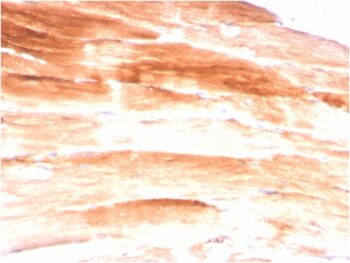 Dystrophin (DMD) (Marker of Duchenne and Becker Muscular Dystrophy)(DMD/3245), CF640R conjugate, 0.1mg/mL