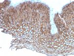 Desmoglein-3 (Squamous Cell Marker)(DSG3/2837), CF640R conjugate, 0.1mg/mL