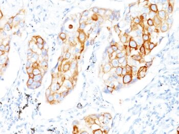 Cytokeratin 7/17(C-46),  CF640R conjugate, 0.1mg/mL