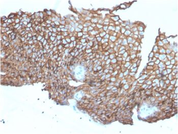 Desmoglein-3 (Squamous Cell Marker)(DSG3/2840), CF740 conjugate, 0.1mg/mL