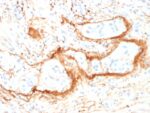 Elastin (ELN) (Marker of Arterial Stiffness and Atherosclerosis) (ELN/1981), 0.2mg/mL