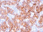 HER-2 / c-erbB-2 / neu / CD340(ERBB2/3079), CF488A conjugate, 0.1mg/mL 1 view_image-397