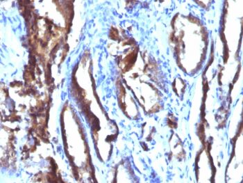 Prostate Specific Antigen (PSA)(3E6), CF640R conjugate, 0.1mg/mL