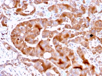 FABP5 (Marker of Metastatic Potential in Colorectal Cancer)(FABP5/3750), CF568 conjugate, 0.1mg/mL