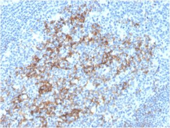 CD23 (Fc Epsilon RII)(FCER2/3592), 0.2mg/mL