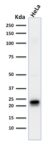 Ferritin, Heavy Chain (FTH) (Microglia Marker)(FTH/2081), CF647 conjugate, 0.1mg/mL 1 view_image-434