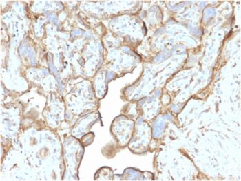 Annexin A1 / (Hairy Cell Leukemia Marker)(CPTC-ANXA1-1), 0.2mg/mL